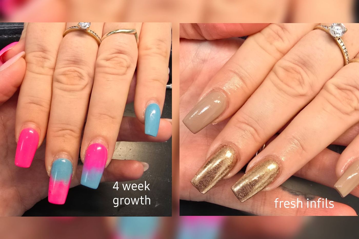Nails at four weeks' growth and after infills